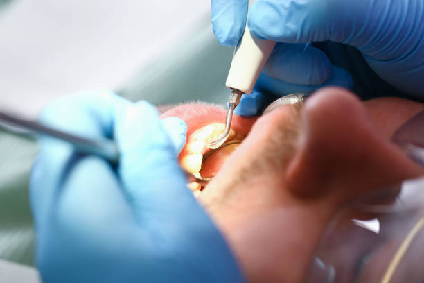 Best Emergency Dental Care for Trauma or Injury in Port Angeles East, WA