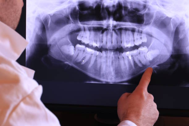  Port Angeles East, WA Emergency Dentist Pros